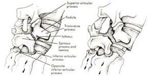 Spondylolisthesis: A Practical Approach to Treatment