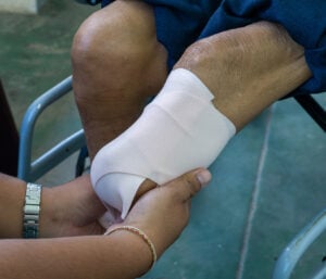 Tackling Phantom Limb Pain: Eight Strategies Worth Considering