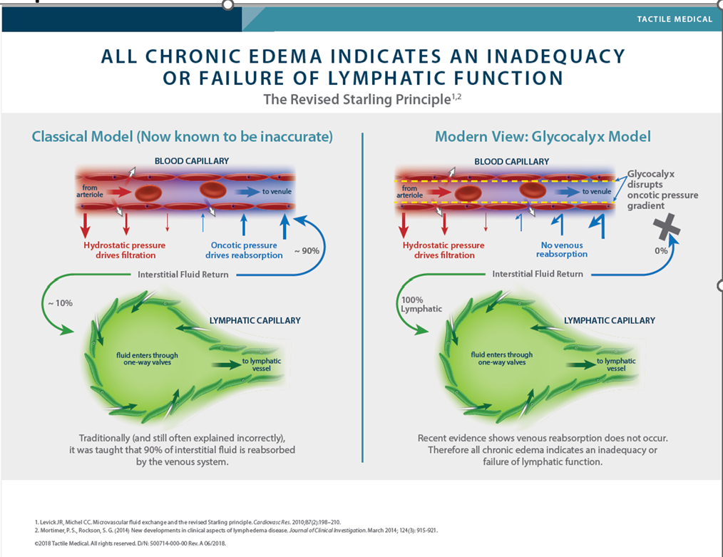 Edema Management: My Head Swells Just Thinking About It!